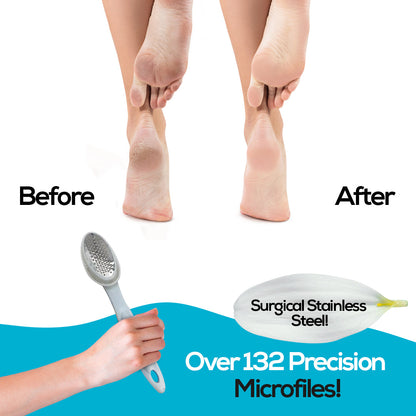 Foot Care Set – Callus Remover, Heel File & Ergonomic Handle
