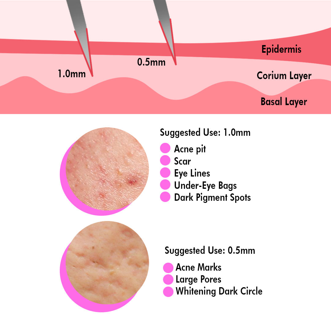 0.25 MM Dermaroller 540 Titanium Micro Needle Roller